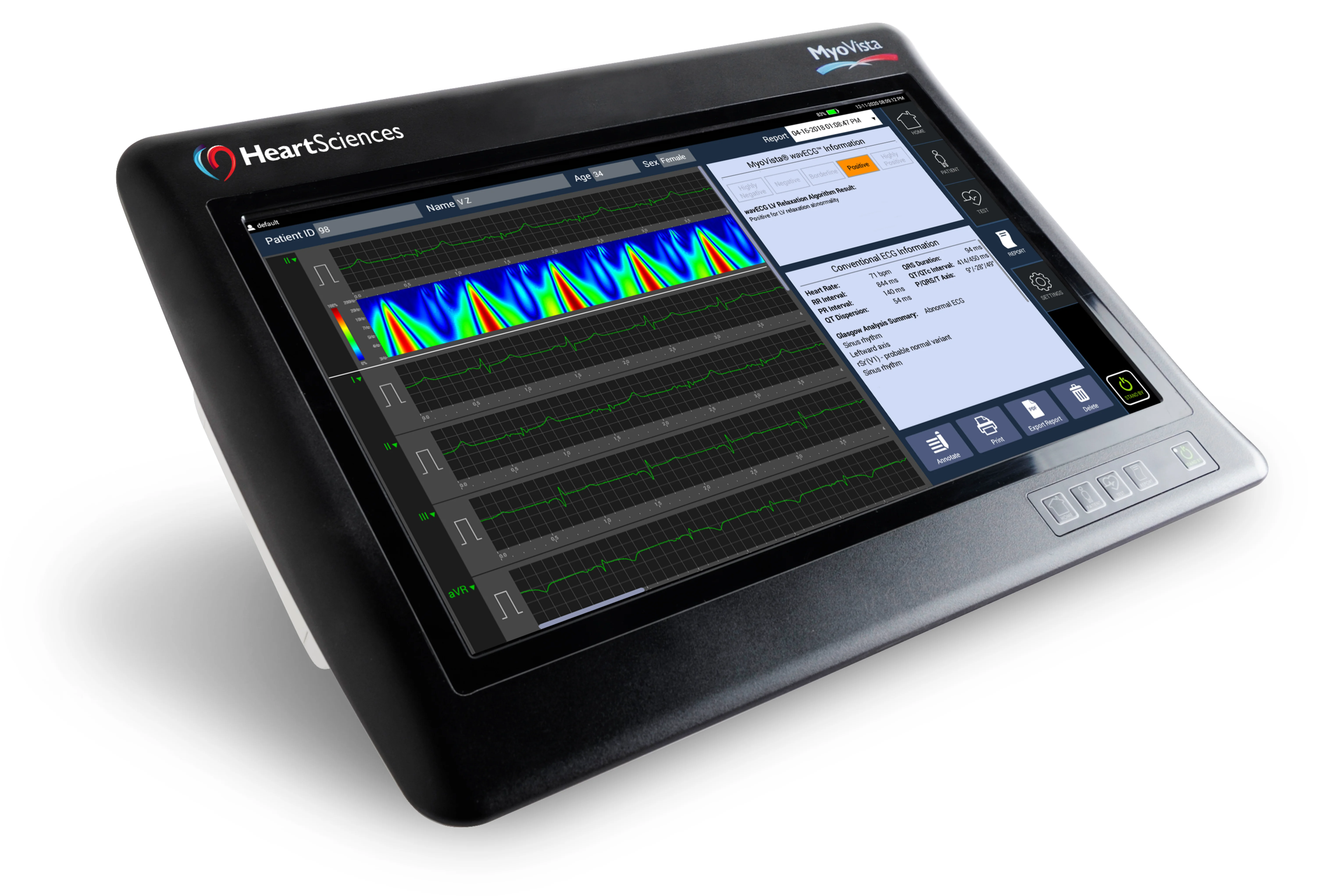 MyoVista wavECG Device - Clinical-Grade ECG Acquisition
