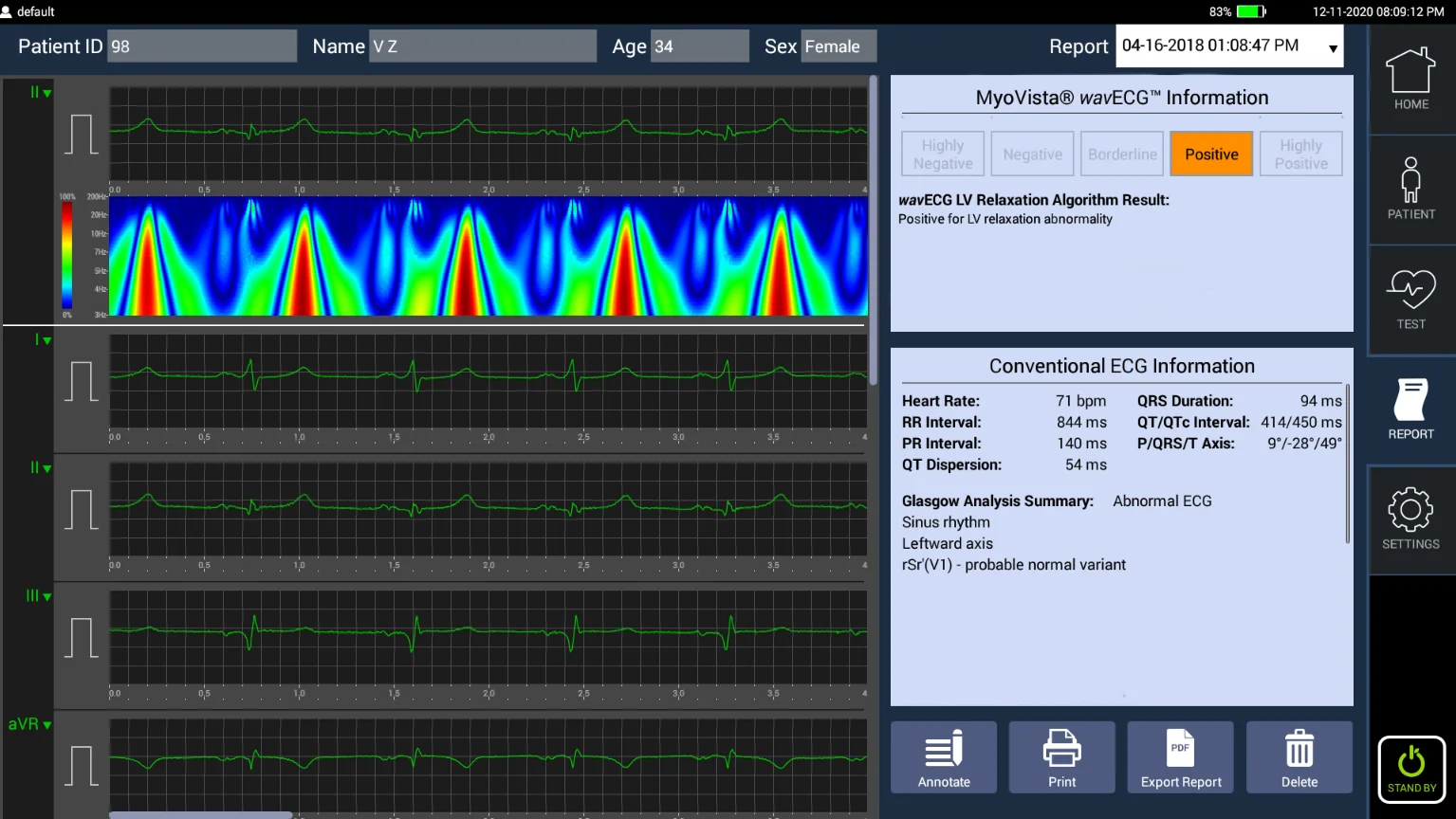 MyoVista wavECG Device - Clinical-Grade ECG Acquisition